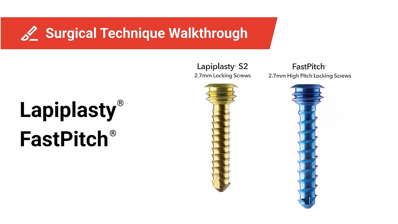 Lapiplasty R Lapiplasty® FastPitch® 2.7mm High Pitch Locking Screws: Fastener ...