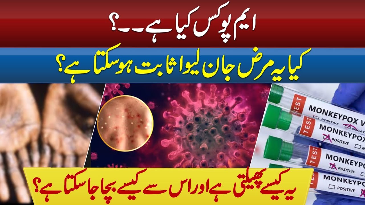 MONKEY POX VIRUS AGAIN TO PAKISTAN | DANGEROUS VIRUS IN PAKISTAN ...