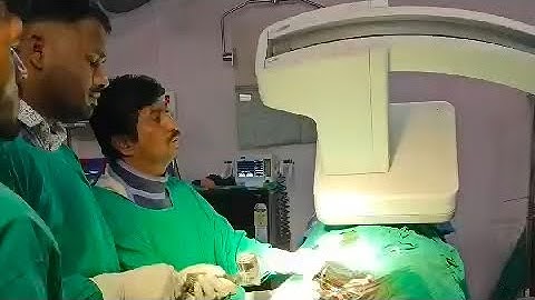 Ostial LAD 💯%(CTO) & LCx 80 % stenosis 🫀