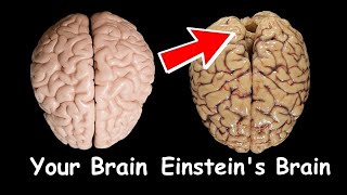 Why Einstein was so smart and had a high iq... Resimi