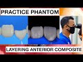 Step by step layering anterior composite  finishing polishing composite  general dentist griya rr