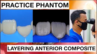 Step by Step Layering Anterior Composite | Finishing Polishing Composite | General Dentist Griya RR