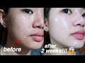 KOREAN SKIN IS REAL!!😱 I TRIED REJUVINATING SET FOR 2 WEEKS AND THIS IS WHAT HAPPENED...