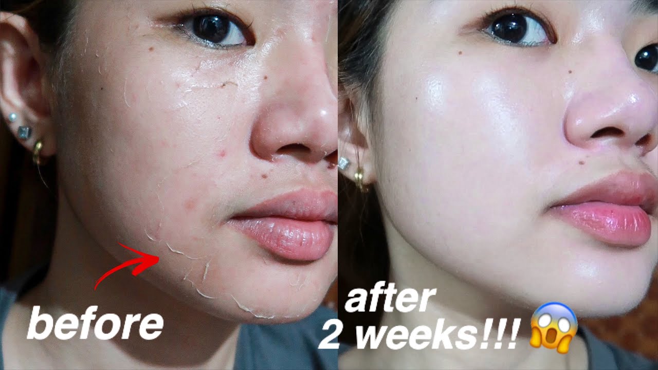 KOREAN SKIN IS REAL!!😱 I TRIED REJUVINATING SET FOR 2 WEEKS AND THIS IS WHAT HAPPENED...