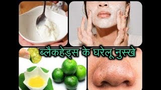 ब्लैकहेड्स के घरेलू नुस्खे| ब्लैकहेड्स और वाइटहेड्स को हटाने के लिए उपाय| screenshot 5