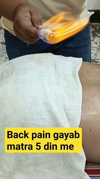 #backpain #cuppingtherapy #hddi #dva #rogi