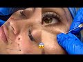 Most Extreme Beauty Treatments 2021 Best Smart and Helpful Beauty Hacks | Virtual Beauty