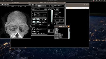[AFNI Academy] Advanced visualization - using SUMA to view two volumes