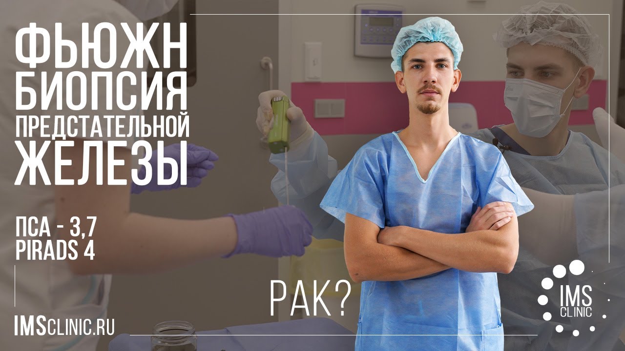 Фьюжн биопсия предстательной железы. Выявлен рак простаты - YouTube