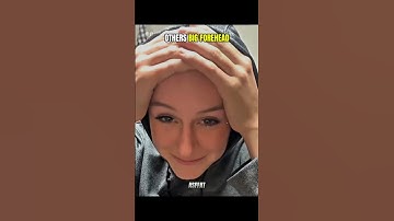 Others Big Forehead VS The Last One. 💀