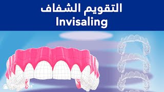 © التقويم الشفاف - علاج تقويم الأسنان مع  انفزلاين