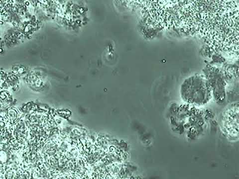 『当院スタッフから採取したプラーク』