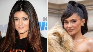 Kylie Jenner's Face - The Dangers of Cosmetic Surgery