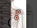 Pectoralis Minor Trigger Points