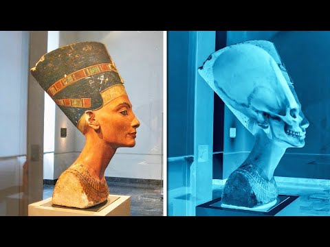 ყველაზე საზარელი აღმოჩენები, რომლებიც რენტგენზე დააფიქსირეს