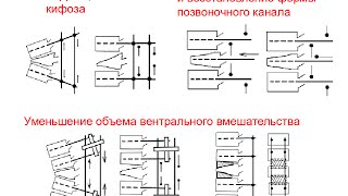 Основные принципы оперативного лечения при ЗПСМТ