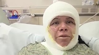 Imperial Beach mother burned in apartment fire gets second chance at life | NBC 7 San Diego