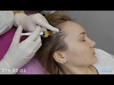 Плазмотерапия для волос и бровей