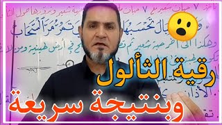 رقية الثألول وبأسرع نتيجة عبدالسميع الشيخ