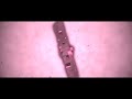 Beginning of video