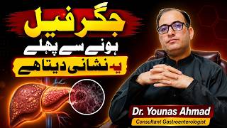 Liver Failure Explained: Causes, Early Symptoms, Diagnosis & Treatment