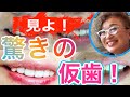 見よ❗️驚きの仮歯❗️