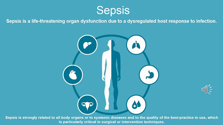 SEPSIS. Educational and Best Practice Frontiers - Video abstract [ID 232530]