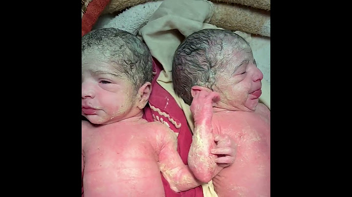 New born twins holding hands together 👏 #twins #twinsouls Dr.naazhasan
