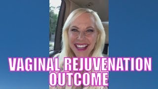 My Vaginal Rejuvenation Outcome | Susan Bratton