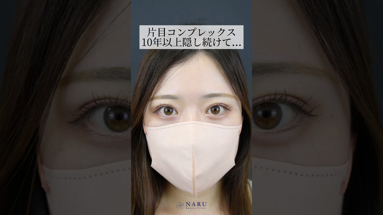 片目コンプレックス。10年以上隠し続けて... 