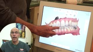Dr. Rafi Romano- Trios 3 shape intra-oral scanner