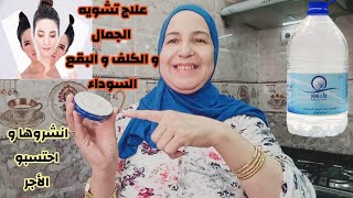 ماء زمزم و عرق السوس داير ضجة علاج تشويه الجمال والبقع السوداء والكلف والدسة