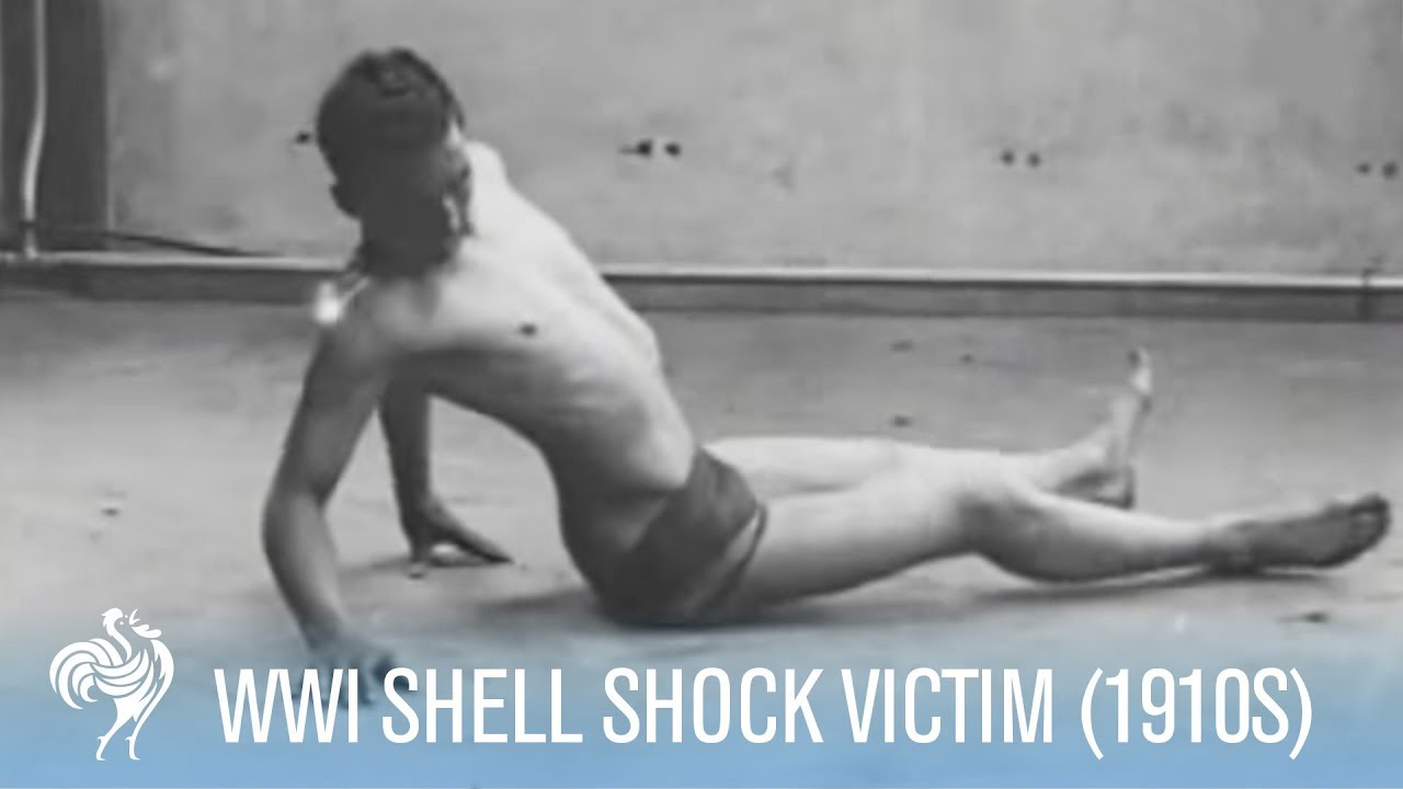 Hypnotism used to treat shell shock victims, First world war