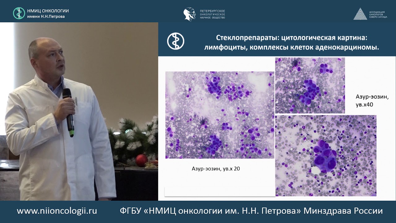 Вакцина от рака институт петрова. НМИЦ онкологии им.Петрова. Мультидисциплинарный подход в онкологии. ФГБУ НМИЦ онкологии им. н. н. Петрова Минздрава России. Иммуноцитохимический метод онкология.