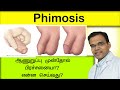 ஆணுறுப்பு முன்தோல் பிரச்சனையா?என்ன செய்வது?phimosis treatment