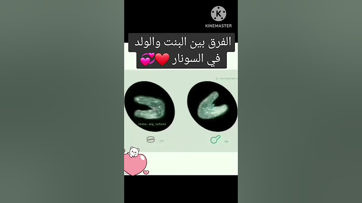 الاختلاف بين الجنين الذكر والجنين الانثى بالسونار