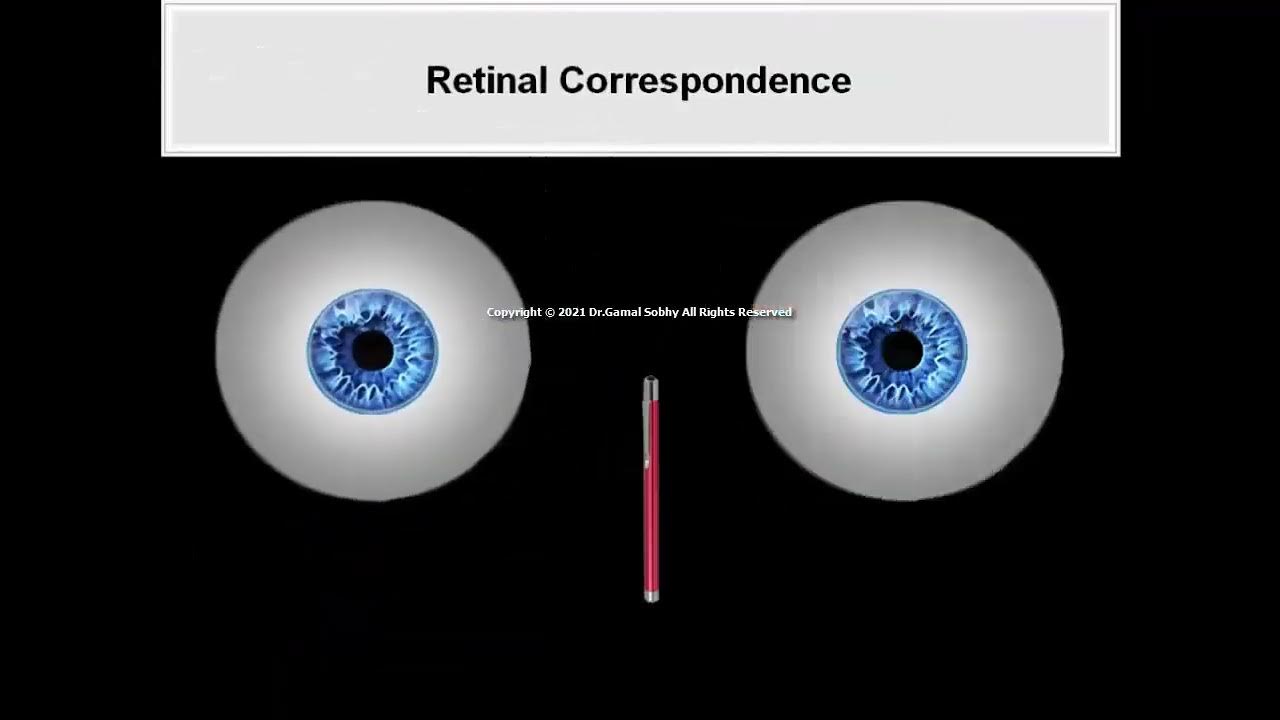2 Binocular Vision and Space Perception Animated Book Binocular Vision