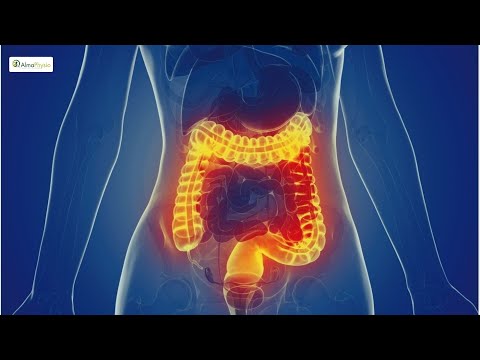 🥩 Laura ha iniziato una dieta chetogenica: ecco cosa è successo al suo intestino