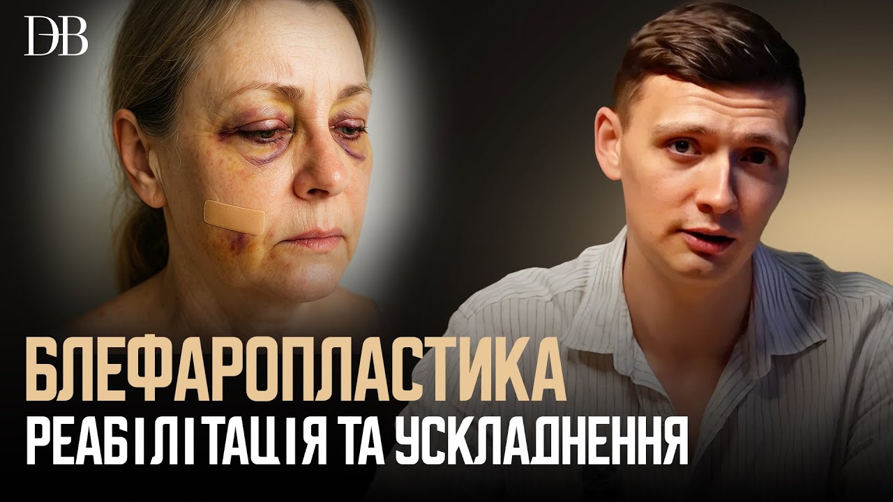 БЛЕФАРОПЛАСТИКА: РЕАБІЛІТАЦІЯ ТА УСКЛАДНЕННЯ | Поради хірурга Дмитра Березовського