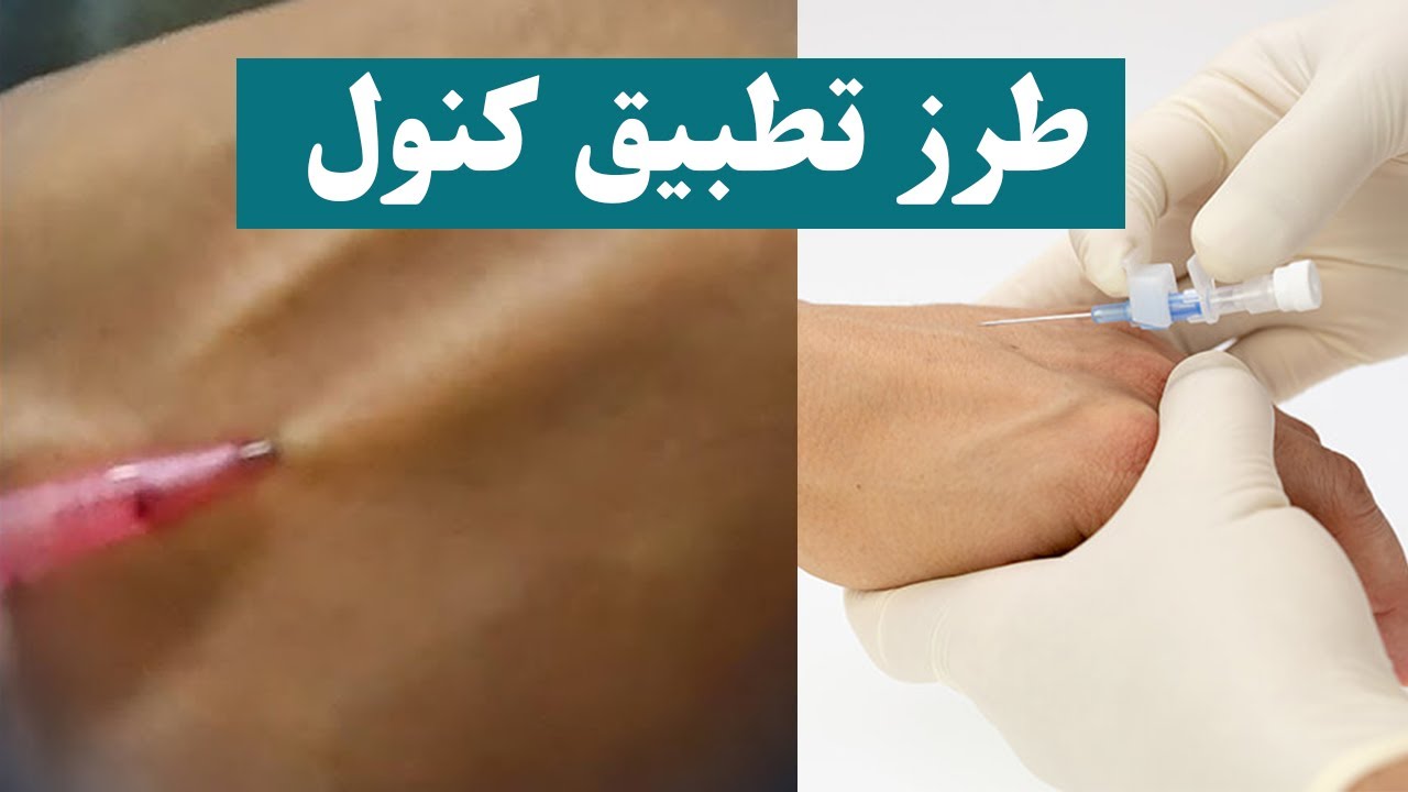 طرز تطبیق کنول ـ د کنول تطبیق کول - YouTube