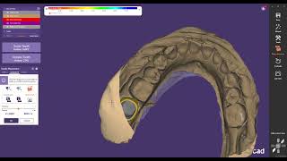 Exocad Tutorial How to Design  postrior Zirconia Crown design