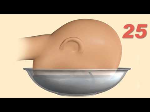 LollipopVideo- 4 მეთოდი სახლის პირობებში გამონაყართან საბრძოლველად