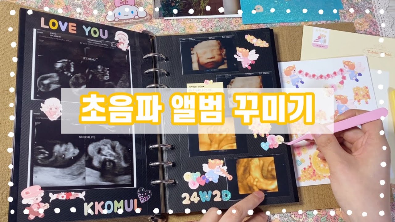 아기 초음파 앨범 꾸미기(Ft. 일상유희) ε♥з | 태교추천!