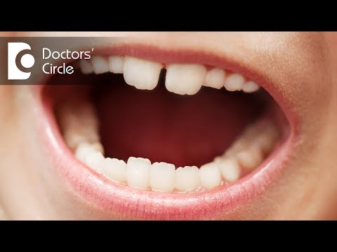 Video: Ali obstajajo 4-letni molarji?