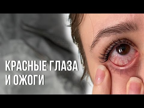 Почему у клиентов краснеют глаза| говорю о здоровье глаз