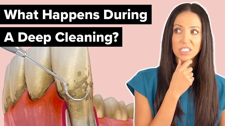 What Happens During a Deep Cleaning Procedure (Scaling and Root Planing) - DayDayNews