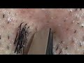 【pull out the beard】ずっと見てられる定番のヒゲ抜き 2018.5.18