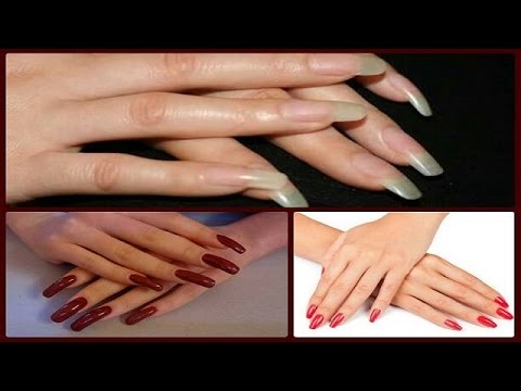 6 दिन में नाखूनों को तेजी से बढ़ाये / How to Grow Nails Quickly in Hindi/ Grow  Nail Fast Naturally - YouTube