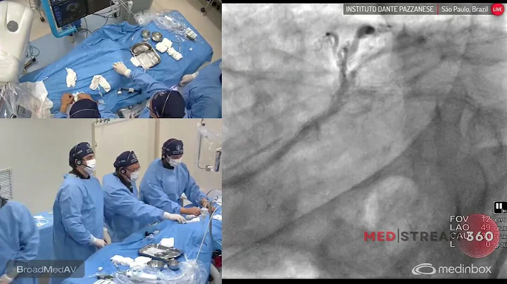 IVUS-Guided PCI To LCx