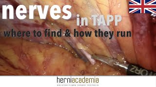 Nerves In Tapp - Where To Find And How They Run? ...And Lipoma Reduction From Internal Ring
